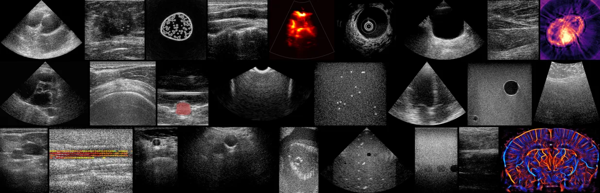 A mosaic of B-mode images from 26 of the datasets: clinical scans, phantoms and simulations.